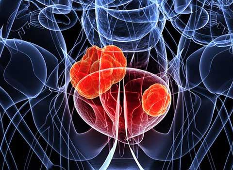 The Prostate